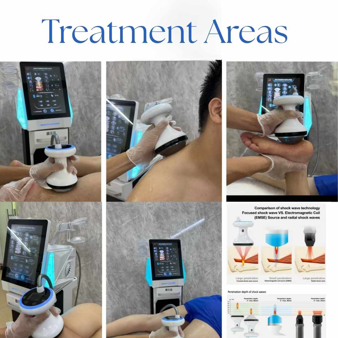 Focus Shockwave Pain Relief Physiotherapy Machine
