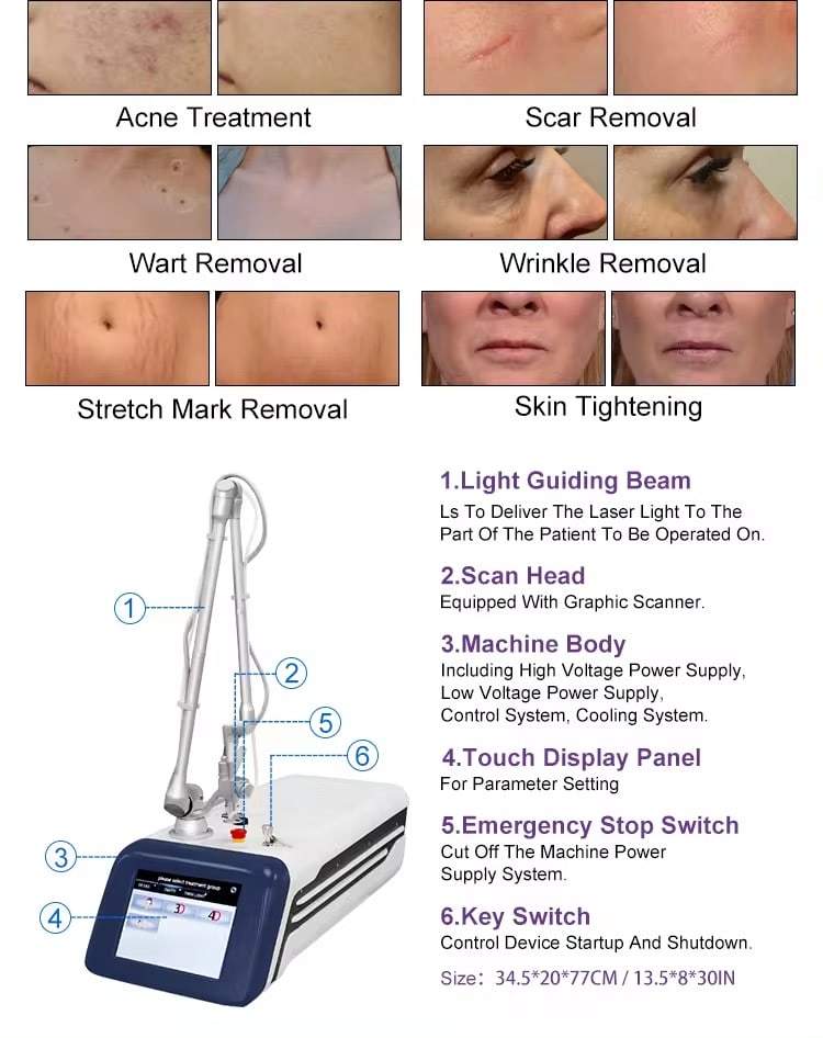 Fractionated CO2 Laser Fractional Skin Resurfacing Machine